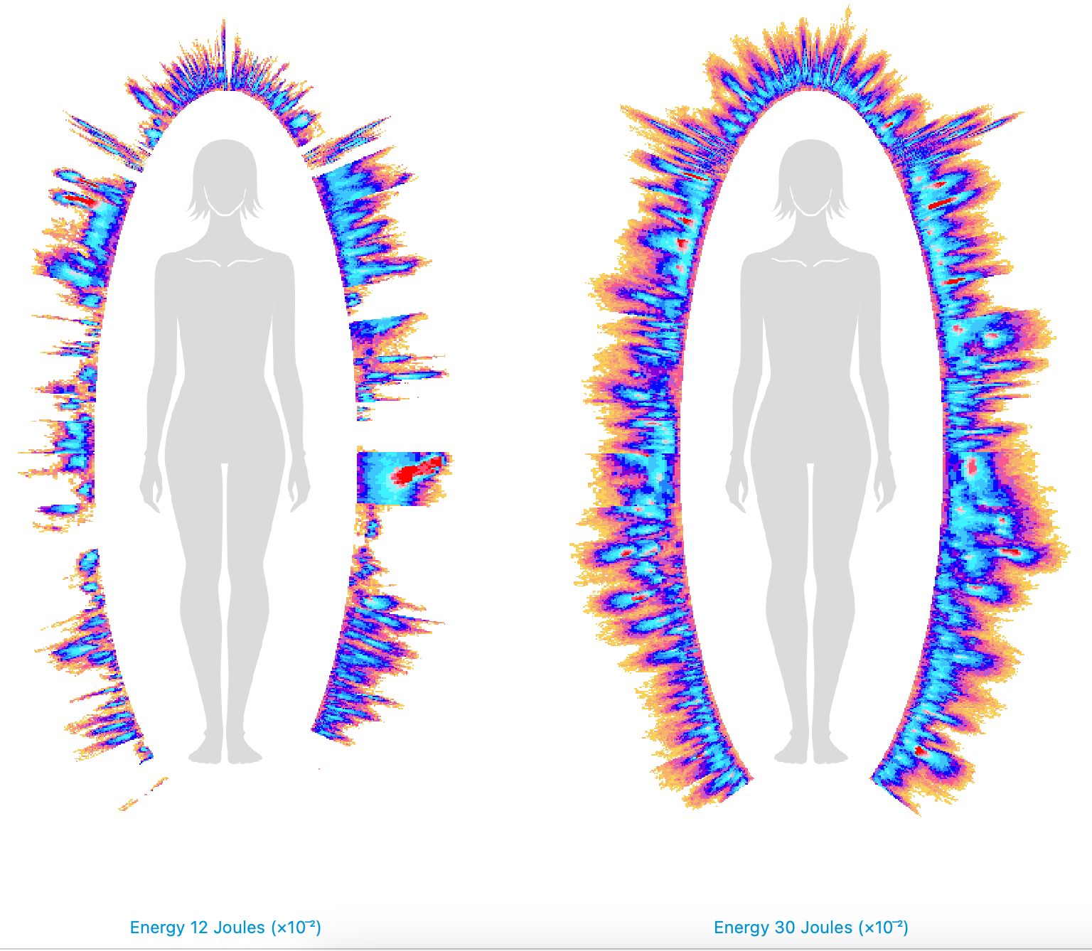 Bio-Well energy scan before and after a Light System session at Rebalance